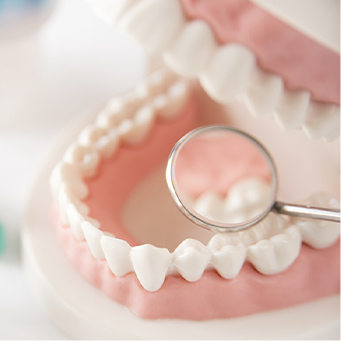 五反田歯科 虫歯治療