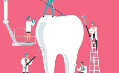歯の治療イラスト