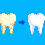 汚れた歯をきれいにホワイトニング｜五反田歯科