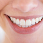 海外では歯の白さは社会的ステータス