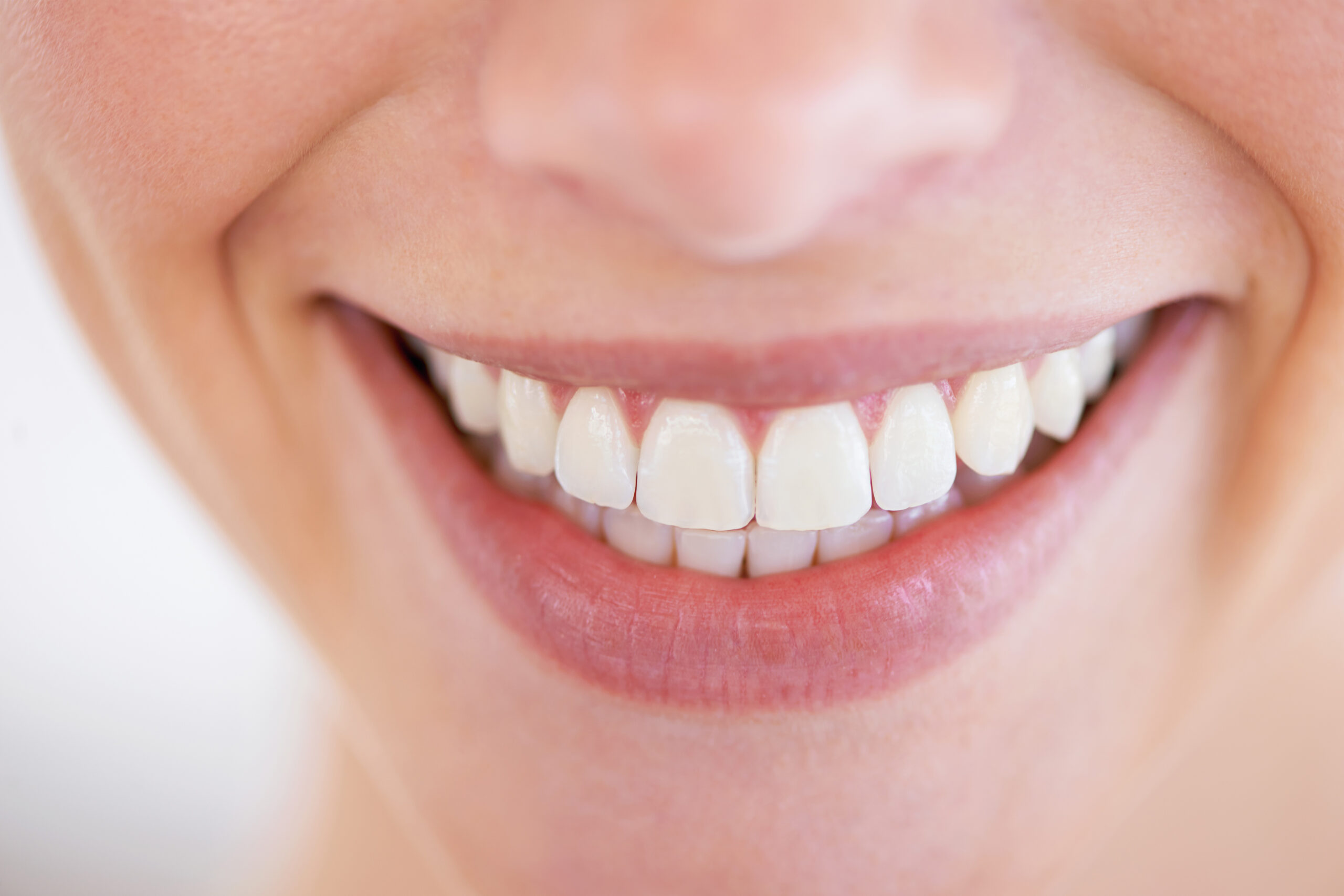 海外では歯の白さは社会的ステータス